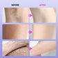 💧 Multi-Use Gentle Effective Hair Removal Cream💗Effortlessly Achieve Smooth Beautiful Skin