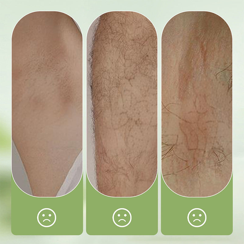 🎁SUMMER HOT SALE🎁Gentle and Non-Irritating Hair Removal Cream