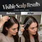 📢📢50% OFF !! ⏰Scalp Applicator Comb Tool for Hair
