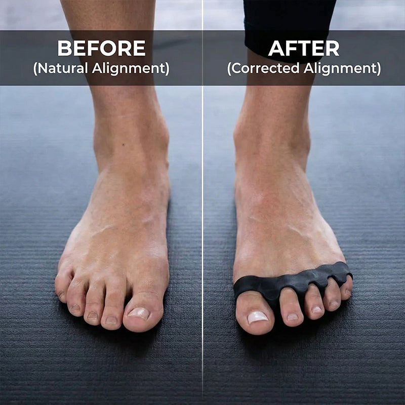Reusable & Washable Foot Alignment Correctors